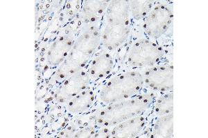 Immunohistochemistry of paraffin-embedded mouse kidney using Phospho-c-Jun-T91 Rabbit pAb (ABIN7268058) at dilution of 1:50 (40x lens). (C-JUN Antikörper  (pThr91))