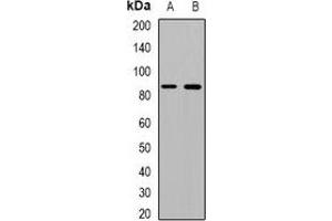 Western blot analysis of Beta Amyloid expression in mouse kidney (A), mouse heart (B) whole cell lysates. (beta Amyloid Antikörper)