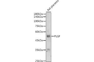 Western blot analysis of extracts of Rat placenta, using PLGF antibody (ABIN7269385) at 1:500 dilution. (PLGF Antikörper)