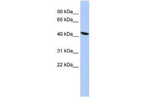 Human PANC1; WB Suggested Anti-ZNF71 Antibody Titration: 1 ug/ml. (ZNF71 Antikörper)