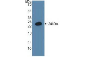 Western blot analysis of recombinant Human GADD45a. (GADD45A Antikörper  (AA 1-165))