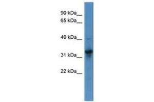 Image no. 1 for anti-T Brachyury Protein (N-Term) antibody (ABIN6746059) (T Brachyury Protein (N-Term) Antikörper)