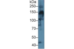Detection of COL4a3 in Mouse Skeletal muscle lysate using Polyclonal Antibody to Collagen Type IV Alpha 3 (COL4a3) (COL4a3 Antikörper  (AA 1428-1670))