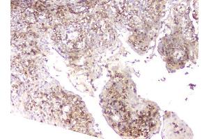 IHC analysis of LCP1 using anti-LCP1 antibody (ABIN6719421). (LCP1 Antikörper)