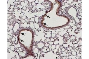 Expression of TRPM4 in rat lung - Immunohistochemical staining of rat lung paraffin embedded sections using Anti-TRPM4 Antibody (ABIN7043833, ABIN7044008 and ABIN7044009), (1:100). (TRPM4 Antikörper  (Intracellular))