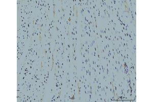 IHC analysis of Cyclophilin E/PPIE using anti-Cyclophilin E/PPIE antibody (ABIN7599243). (PPIE Antikörper  (AA 1-301))
