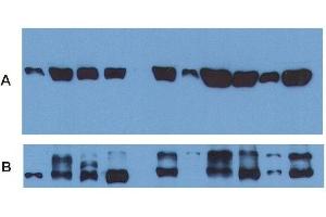 Use of anti-alpha-tubulin antibody as a loading control (A) in an Western blotting experiment revealing the staining pattern ofvarious cell lysates by a newly developed monoclonal antibody (B). (alpha Tubulin Antikörper  (FITC))