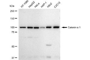 Western blotting analysis using Catenin alpha 1 antibody (ABIN7797923).