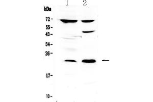 Western blot analysis of TRFP / MED20 using anti-TRFP / MED20 antibody . (MED20 Antikörper  (AA 1-212))