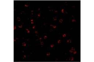 Immunofluorescence of ATG7 in MCF7 cells with ATG7 Antibody at 20 µg/ml. (ATG7 Antikörper  (C-Term))