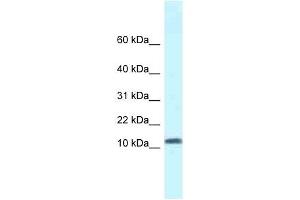 Western Blot showing SSBP1 antibody used at a concentration of 1 ug/ml against Fetal Kidney Lysate (SSBP1 Antikörper  (N-Term))