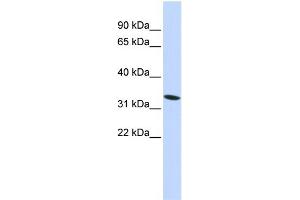 WB Suggested Anti-HMG20A Antibody Titration: 0. (HMG20A Antikörper  (N-Term))