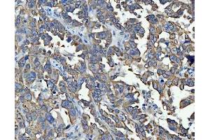 IHC analysis of TRAM1L1 using anti-TRAM1L1 antibody (ABIN7602939). (TRAM1L1 Antikörper  (C-Term))