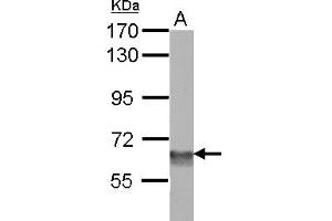 Western Blotting (WB) image for anti-SWI/SNF Related, Matrix Associated, Actin Dependent Regulator of Chromatin, Subfamily D, Member 3 (SMARCD3) (AA 105-441) antibody (ABIN1501913)