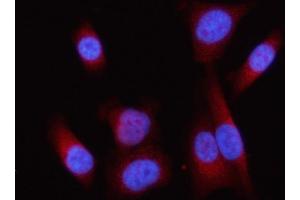 IF analysis of Lipin 1/LPIN1 using anti-Lipin 1/LPIN1 antibody (ABIN7602648).