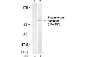 Western blot analysis of extracts from SKOV3 cells untreated(lane 1) or treated with EGF(lane 2) using Progesterone Receptor(Phospho-Ser190) Antibody. (Progesterone Receptor Antikörper  (pSer190))