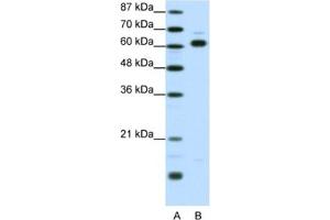 Western Blotting (WB) image for anti-Thyroid Hormone Receptor Interactor 4 (TRIP4) antibody (ABIN2461241)