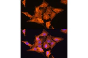 Immunofluorescence analysis of C6 cells using ALDOC Rabbit pAb (ABIN6129897, ABIN6136788, ABIN6136789 and ABIN6215308) at dilution of 1:100. (ALDOC Antikörper  (AA 1-170))