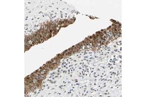 Immunohistochemical staining (Formalin-fixed paraffin-embedded sections) of human urinary bladder with MINA polyclonal antibody  shows strong nuclear and cytoplasmic positivity in urothelial cells.