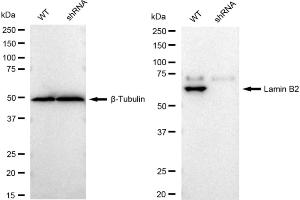 Western blotting analysis using Lamin B2 antibody (ABIN7799233). (Rekombinanter Lamin B2 Antikörper)
