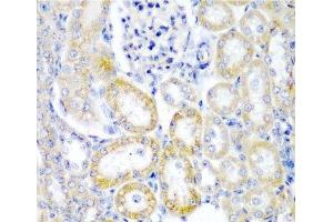 Immunohistochemistry of paraffin-embedded Rat kidney using UPF2 Polyclonal Antibody at dilution of 1:200 (40x lens). (RENT2/UPF2 Antikörper)