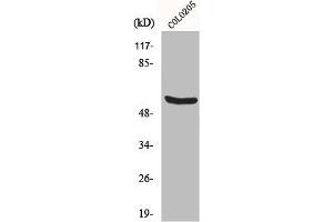 Western Blot analysis of COLO205 cells using HSP60 Polyclonal Antibody