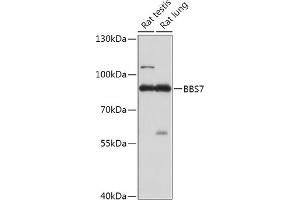 Western blot analysis of extracts of various cell lines, using BBS7 antibody (ABIN7265825) at 1:1000 dilution. (BBS7 Antikörper  (AA 1-270))