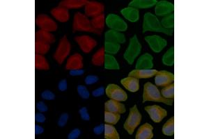 C14orf37 Antibody staining Hela cells(45 min of heat-shock treatment) by IF/ICC. (C14ORF37 Antikörper)