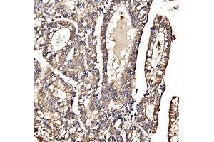 IHC analysis of MPPB/PMPCB using anti-MPPB/PMPCB antibody (ABIN7600758). (PMPCB Antikörper  (AA 23-479))