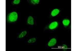 Immunofluorescence of monoclonal antibody to HOXD3 on HeLa cell. (HOXD3 Antikörper  (AA 334-431))