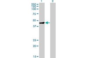 Western Blot analysis of MAGEA9 expression in transfected 293T cell line by MAGEA9 MaxPab polyclonal antibody. (MAGEA9 Antikörper  (AA 1-315))
