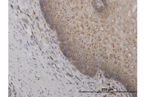 Immunoperoxidase of monoclonal antibody to RPS2 on formalin-fixed paraffin-embedded human esophagus. (RPS2 Antikörper  (AA 198-293))