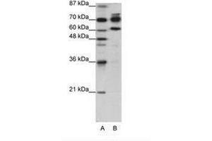 Image no. 1 for anti-Adenosine Deaminase, RNA-Specific, B1 (ADARB1) (AA 40-89) antibody (ABIN203245) (RED1 Antikörper  (AA 40-89))