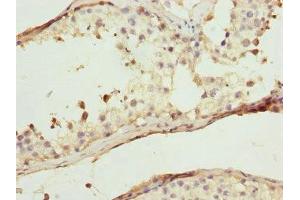 Immunohistochemistry of paraffin-embedded human testis tissue using ABIN7175708 at dilution of 1:100 (WIPI2 Antikörper  (AA 205-454))