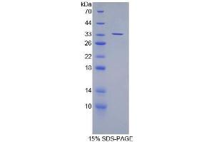 SDS-PAGE (SDS) image for Suppressor of Variegation 4-20 Homolog 2 (SUV420H2) (AA 2-279) protein (His tag) (ABIN1080876) (SUV420H2/KMT5C Protein (AA 2-279) (His tag))