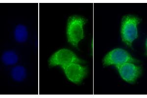 Detection of PDHb in Human Hela cell using Polyclonal Antibody to Pyruvate Dehydrogenase Beta (PDHb) (PDHB Antikörper  (AA 31-341))