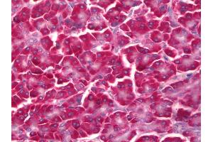 Immunohistochemistry (IHC) image for anti-Eukaryotic Translation Initiation Factor 2, Subunit 3 Gamma, 52kDa (EIF2S3) antibody (ABIN961315)