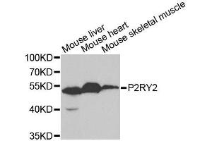 Western blot analysis of extracts of various cell lines, using P2RY2 antibody. (P2RY2 Antikörper  (AA 278-377))
