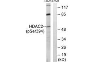 Western blot analysis of extracts from LOVO cells, using HDAC2 (Phospho-Ser394) Antibody. (HDAC2 Antikörper  (pSer394))