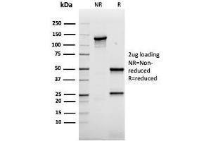 SDS-PAGE Analysis Purified AKT1 Recombinant Mouse Monoclonal Antibody (rAKT1/2491). (Rekombinanter AKT1 Antikörper  (AA 85-189))