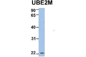 Western Blotting (WB) image for anti-Ubiquitin-Conjugating Enzyme E2M (ube2m) (N-Term) antibody (ABIN2775686)