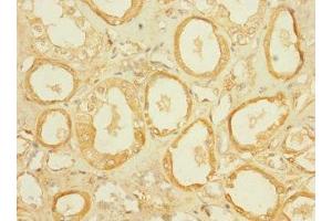 Immunohistochemistry of paraffin-embedded human kidney tissue using ABIN7170015 at dilution of 1:100