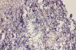 Anti-FOXP3 Picoband antibody,  IHC(P):Rat Spleen Tissue