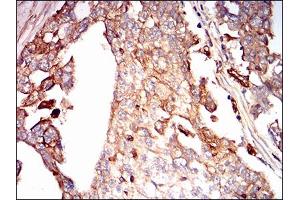 Immunohistochemistry (IHC) image for anti-Syndecan 1 (SDC1) (AA 28-171) antibody (ABIN1724936)