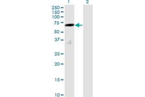 Western Blot analysis of DCP1A expression in transfected 293T cell line by DCP1A monoclonal antibody (M01), clone 2D12.