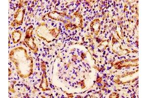 Immunohistochemistry (IHC) image for anti-RAB3 GTPase Activating Protein Subunit 1 (Catalytic) (RAB3GAP1) (AA 527-653), (Catalytic Subunit) antibody (ABIN7166993)