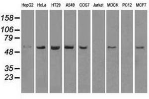 Image no. 6 for anti-Transmembrane Protein 100 (TMEM100) antibody (ABIN1501422) (TMEM100 Antikörper)