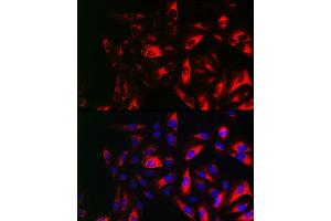 Immunofluorescence analysis of U2OS cells using RRM2 Rabbit pAb (ABIN6129715, ABIN6147265, ABIN6147266 and ABIN6220890) at dilution of 1:150 (40x lens). (RRM2 Antikörper  (AA 1-389))