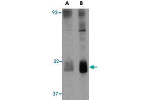 Western blot analysis of WNT10B in human skeletal muscle tissue lysate with WNT10B polyclonal antibody  at (A) 2 and (B) 4 ug/mL . (WNT10B Antikörper  (Internal Region))