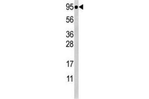 Western Blotting (WB) image for anti-Signal Transducer and Activator of Transcription 5A (STAT5A) (pSer726) antibody (ABIN5021402) (STAT5A Antikörper  (pSer726))